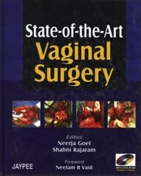 State-of-the-Art Vaginal Surgery (with DVD-ROM)