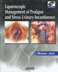 Laparoscopic Management of Prolapse and Stress Urinary Incontinence with 2 DVD-ROMs 1st Edition