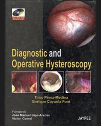Diagnostic and Operative Hysterocopy with DVD-ROM