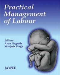 Practical Management of Labor