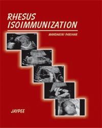 Rhesus Isoimmunization (FOGSI)