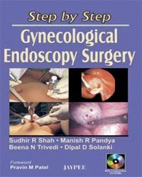 Step by Step Gynecological Endoscopy Surgery with 2 CD-ROMs