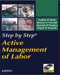 Step by Step Active Management of Labor (with interactive DVD-ROM)