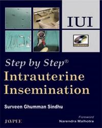 Step by Step intrauterine insemination with DVD-ROM