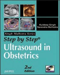 Step by Step Ultrasound in Obstetrics with Photo CD-ROM