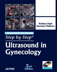 Step by Step Ultrasound in Gynecology 2 Rev ed Edition