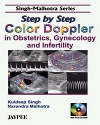 Step by Step color doppler in obstetrics, Gynecology and infertility