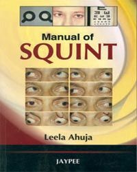 Manual of Squint