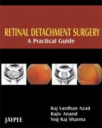 Retinal Detachment Surgery: A Practical Guide (Full Colour) 1st Edition 