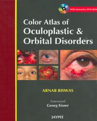 Color Atlas of Oculoplastic & Orbital Disorders (with interactive DVD-ROM)