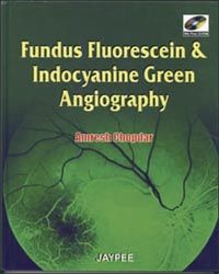 Fundus Fluorescien and Indocyanine: Green Angiography 1st Edition