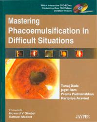 Mastering Phacoemulsification in Difficult Situations with 4 DVD-ROMs 1st Edition
