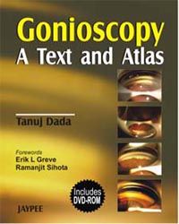 Gonioscopy: A Text and Atlas with DVD-ROM