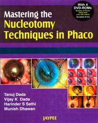 Mastering the Nucleotomy Techniques in Phaco (with 4 DVD-ROMs) 1st Edition 