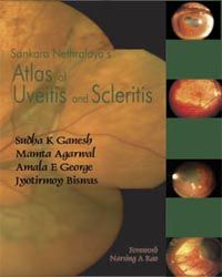 Sankara Nethralaya`s Atlas of Uveitis and Scleritis