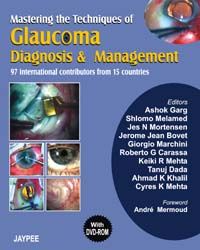 Mastering the Techniques of Glaucoma Diagnosis and Management with DVD-ROM (Complete Book Available in PDF Format) 1st Edition 