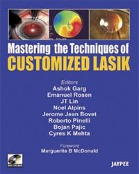 Mastering the Technique of Customised LASIK with DVD-ROM