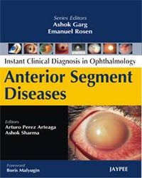 Instant Clinical Diagnosis in Ophthalmology: Anterior Segment Lens Diseases 