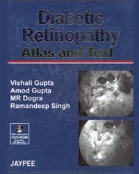 Diabetic Retinopathy: Atlas and Text with DVD-ROM