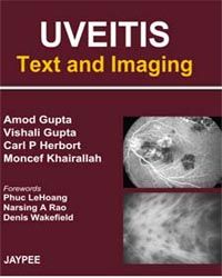 Uveitis: Text and Imaging ,1/e