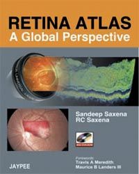 Retina Atlas with DVD-ROM