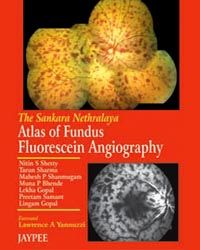 The Sankara Nethralaya Atlas of Fundus Fluorescein Angiography