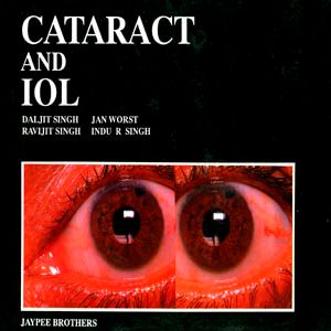 Cataract and introcular Lens 