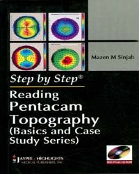 		 	 Step by Step Reading Pentacam Topography (Basic and Case Study Series) With CD-Rom 