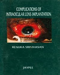 Complications of intraocular Lens Implantation 
