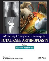 Mastering Orthopedic Techniques Total knee Arthroplasty 