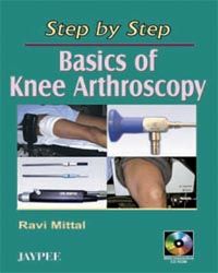 Step by Step Basics of Knee Arthroscopy with CD-ROM 