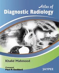 Atlas of Diagnostic Radiology
