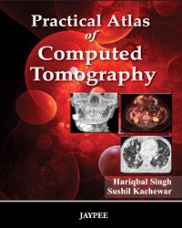  PRACTICAL ATLAS OF COMPUTED TOMOGRAPHY,2011