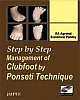 Step By Step Management of Clubfoot By Ponseti Technique with DVD-ROM 1st Edition 