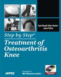 Step by Step Treatment of Osteoarthritis Knee with DVD Rom 