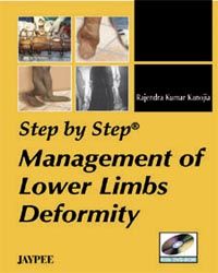 Step by Step Management of Lower Limbs Deformity with DVD-ROM 