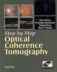 Step by Step Optical Coherence tomography with Photo CD-ROM 