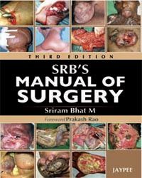 SRB`s Manual of Surgery