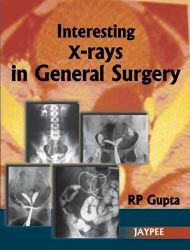  Interesting X-rays in General Surgery 1st Edition
