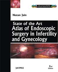 State of The Art Atlas and Endoscopy Surgery in Infertility and Gynecology With 4 DVD-ROMs 2 Rev ed Edition