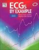 ECGs By Example, 2/e