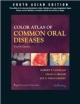 Color Atlas of Common Oral Diseases, 4/e  