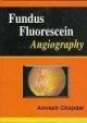 Fundus Fluorescein Angiography