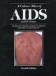 A Colour Atlas Of Aids And Hiv Diagnosis, 2nd edition