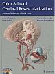 Color Atlas Of Cerebral  Revascularization: Anatomy, Techniques, Clinical Cases (Hb 2013)