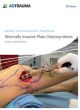 Minimally Invasive Plate Osteosynthesis (Mipo) 2nd Edition (Hb 2012)