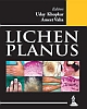 Lichen planus  2013