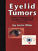 Eyelid Tumors: Clinical Diagnosis & Surgical Treatment