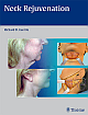 Neck Rejuvenation 