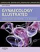 Gynaecology Illustrated International Edition 6/E